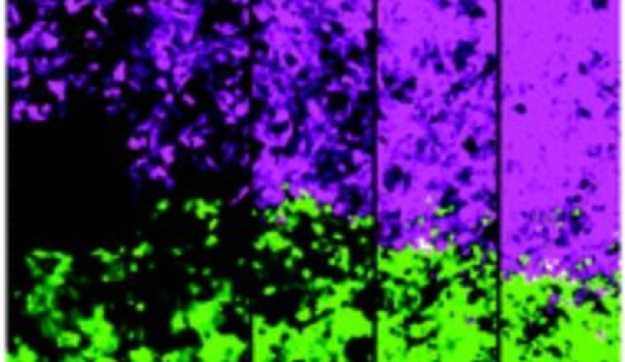 Proyect Mathematics applied to Biomedicine